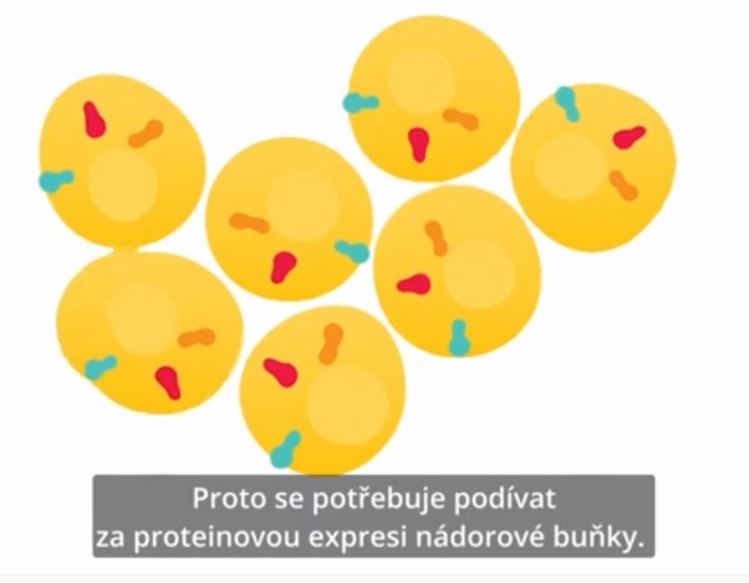 Porozumět biologii svých pacientů s rakovinou prsu – video